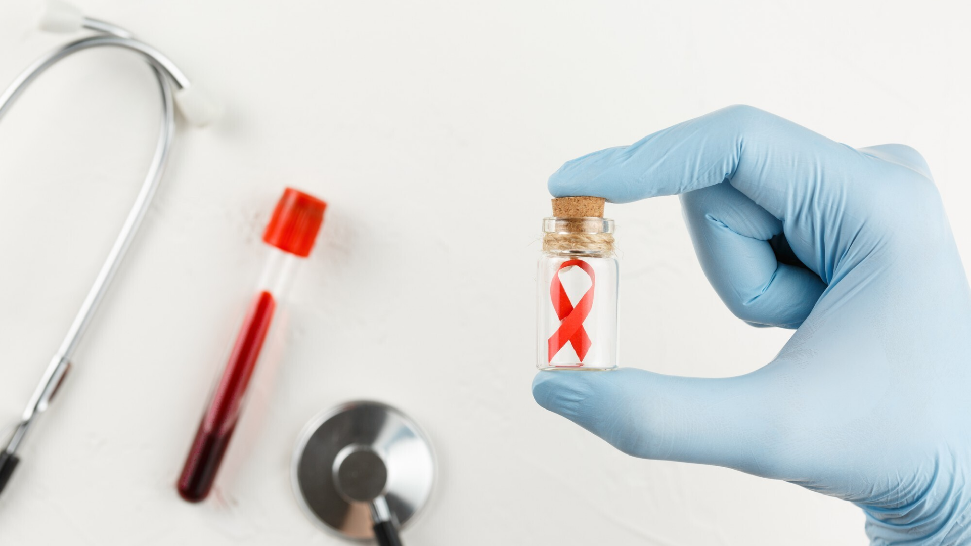 Xét nghiệm HIV giúp phát hiện bệnh sớm