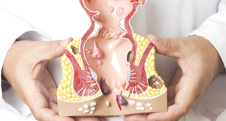 Bài thuốc từ quả vả