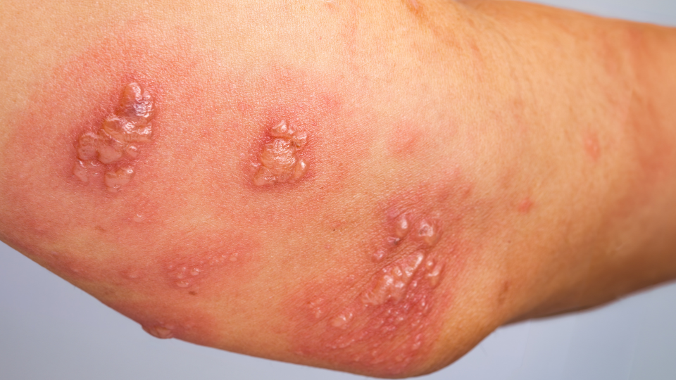 Giời leo giai đoạn toàn phát