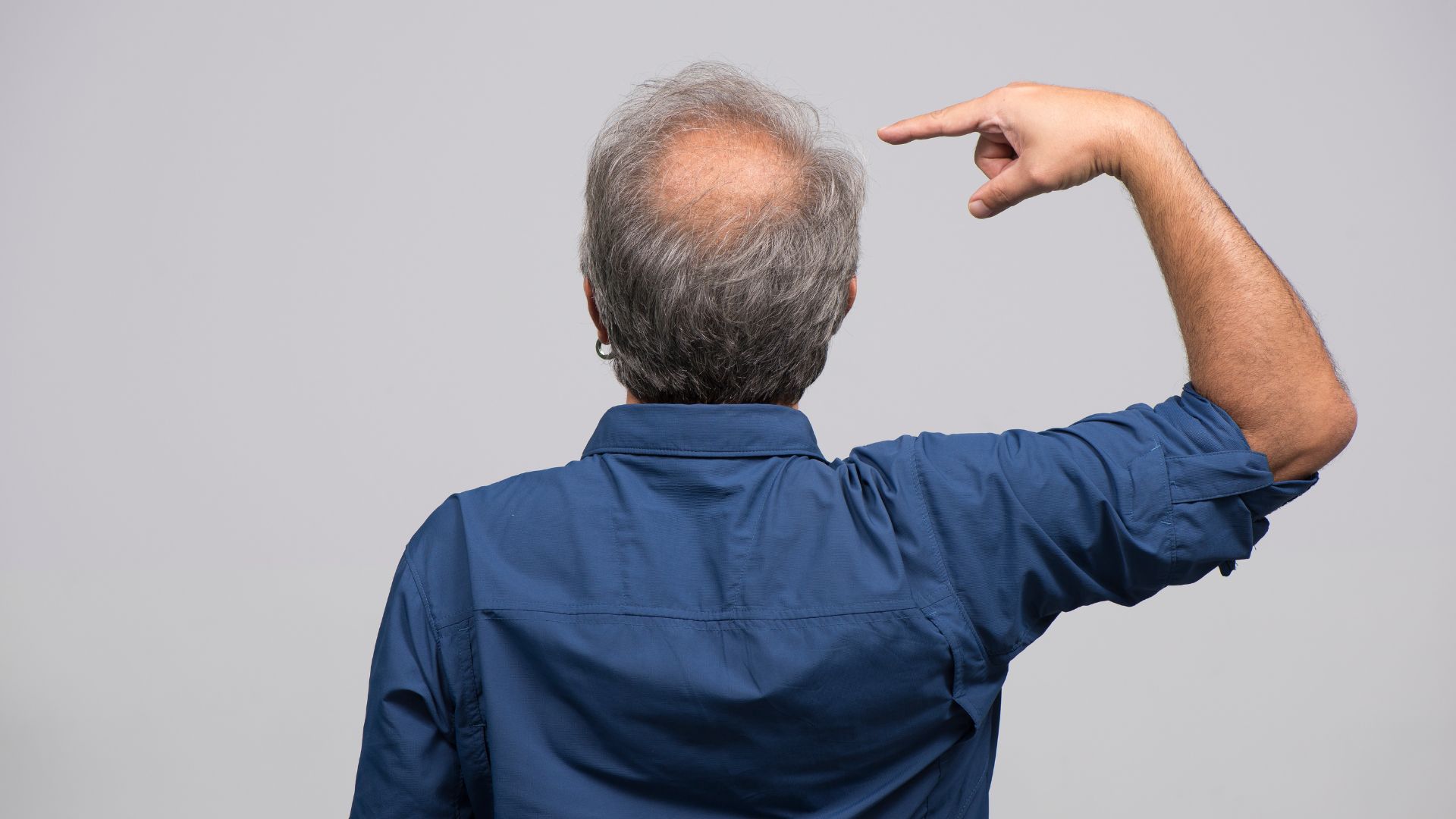 Rụng tóc từng mảng