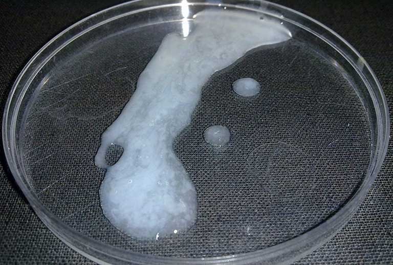 Tinh trùng bình thường